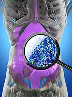 staph aureus, traditional treatments