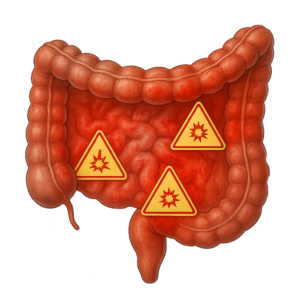 Unhealthy and inflamed intestines