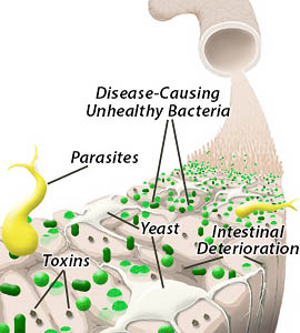 Unhealthy intestines